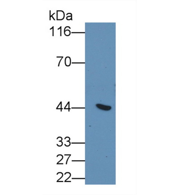 Cytokeratin 19 (CK19) Human Monoclonal Antibody