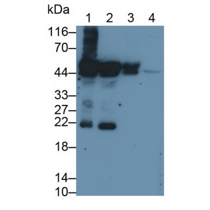 Cytokeratin 20 (CK 20) Human Monoclonal Antibody
