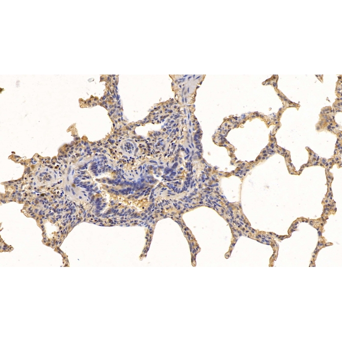 Heart-type Fatty Acid Binding Protein (H-FABP) Human Monoclonal Antibody