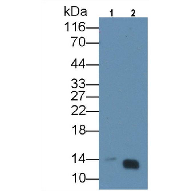 Heart-type Fatty Acid Binding Protein (H-FABP) Human Monoclonal Antibody