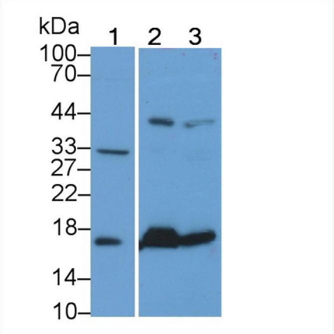 Heart-type Fatty Acid Binding Protein (H-FABP) Human Monoclonal Antibody