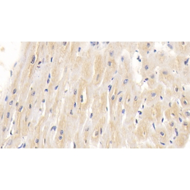 Heart-type Fatty Acid Binding Protein (H-FABP) Human Monoclonal Antibody