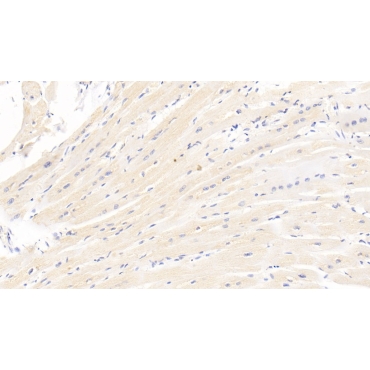 Heart-type Fatty Acid Binding Protein (H-FABP) Human Monoclonal Antibody