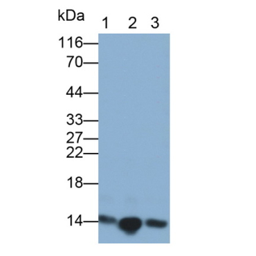 Heart-type Fatty Acid Binding Protein (H-FABP) Human Monoclonal Antibody
