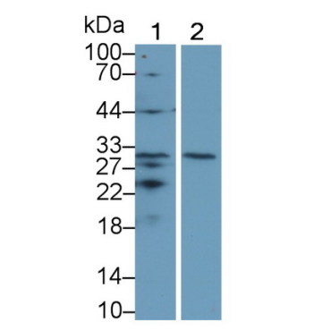 Tumor Necrosis Factor Receptor Superfamily, Member 5 (CD40) Human Monoclonal Antibody