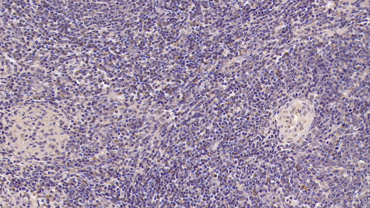Tumor Necrosis Factor Receptor Superfamily, Member 5 (CD40) Human Monoclonal Antibody