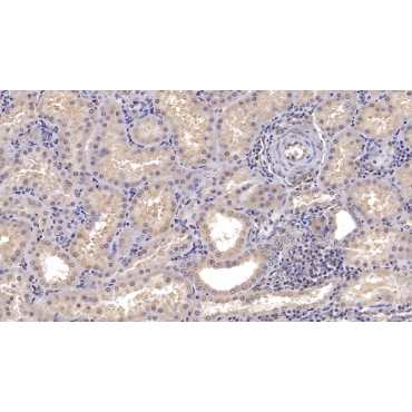 Cluster Of Differentiation 73 (CD73) Human Monoclonal Antibody