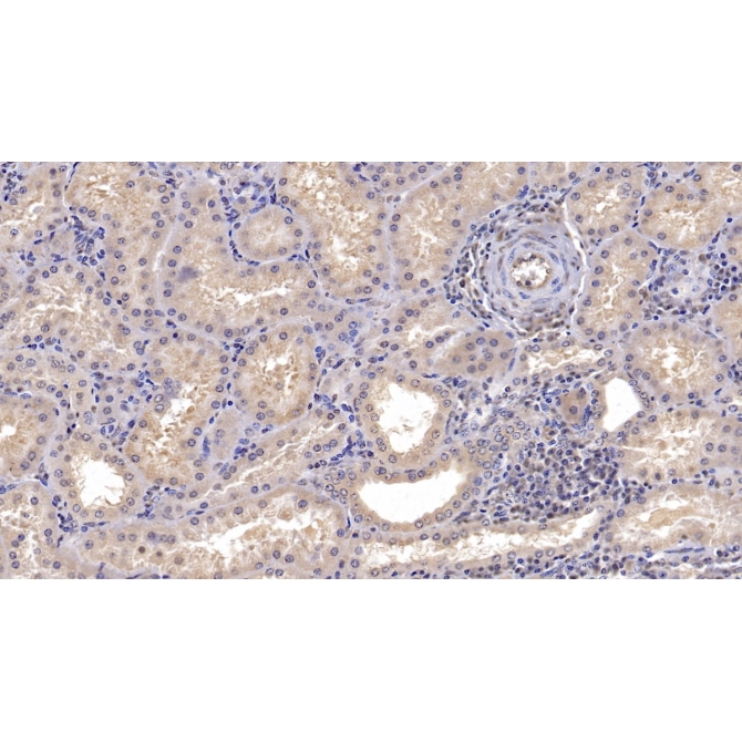 Cluster Of Differentiation 73 (CD73) Human Monoclonal Antibody