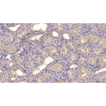 Cluster Of Differentiation 73 (CD73) Human Monoclonal Antibody