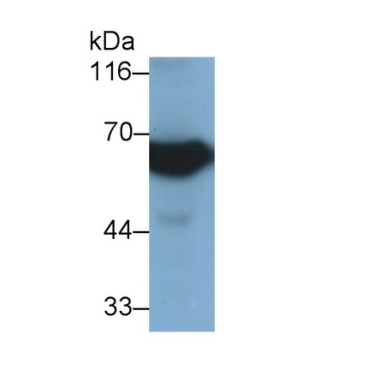 Cluster Of Differentiation 73 (CD73) Human Monoclonal Antibody