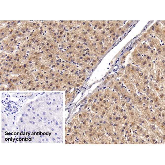 Angiostatin (ANG) Human Monoclonal Antibody