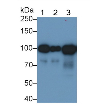 Angiostatin (ANG) Human Monoclonal Antibody