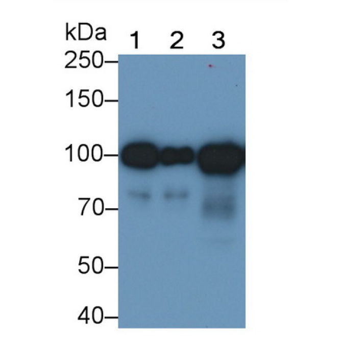 Angiostatin (ANG) Human Monoclonal Antibody