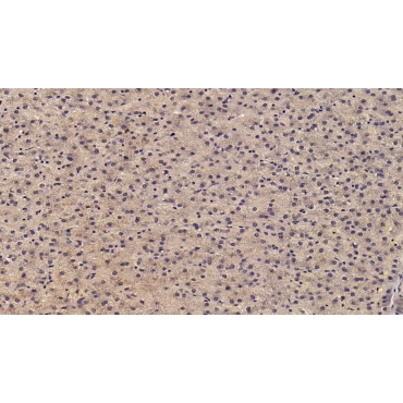Angiostatin (ANG) Human Monoclonal Antibody