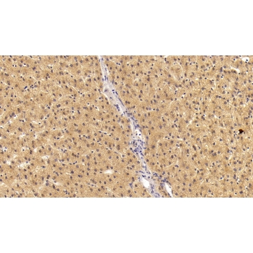 Angiostatin (ANG) Human Monoclonal Antibody