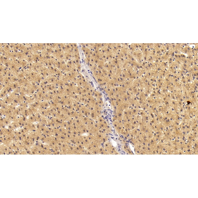 Angiostatin (ANG) Human Monoclonal Antibody