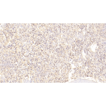 Cluster Of Differentiation 72 (CD72) Human Monoclonal Antibody