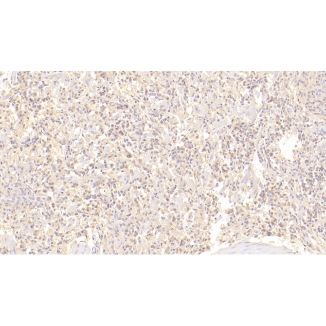 Cluster Of Differentiation 72 (CD72) Human Monoclonal Antibody