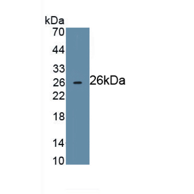 Cluster Of Differentiation 72 (CD72) Human Monoclonal Antibody