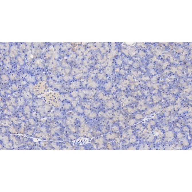 Glucagon (GCG) Human Monoclonal Antibody
