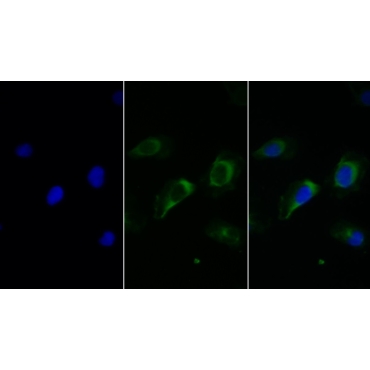 Fc Fragment Of IgG Low Affinity IIIb Receptor (FcgR3B) Human Monoclonal Antibody
