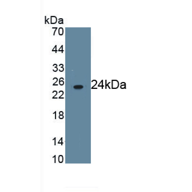 Fc Fragment Of IgG Low Affinity IIIb Receptor (FcgR3B) Human Monoclonal Antibody