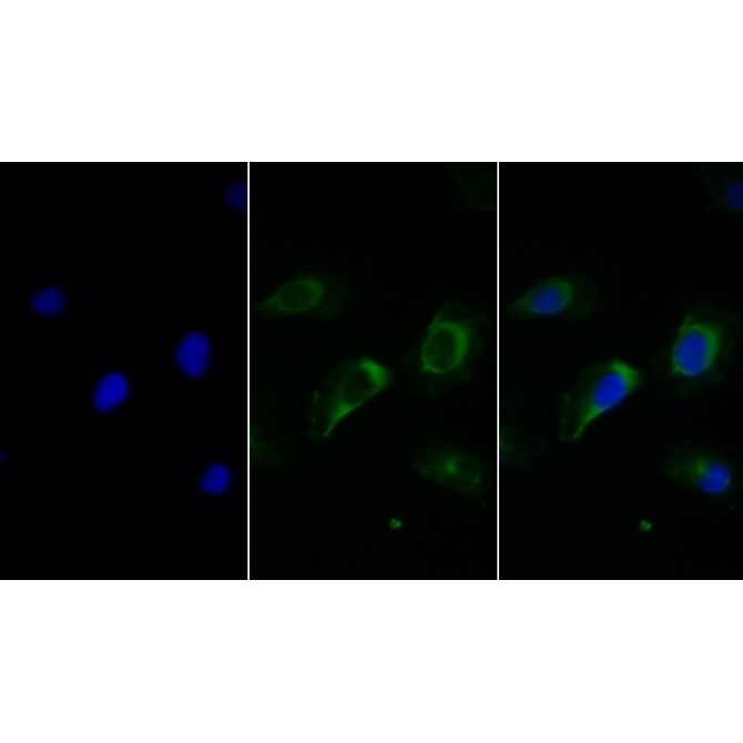 Fc Fragment Of IgG Low Affinity IIIb Receptor (FcgR3B) Human Monoclonal Antibody