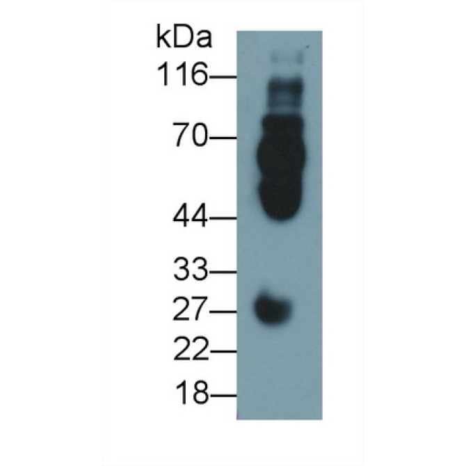 Fc Fragment Of IgG Low Affinity IIIb Receptor (FcgR3B) Human Monoclonal Antibody