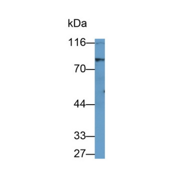 Lipase, Hormone Sensitive (LIPE) Human Monoclonal Antibody