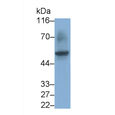 Fc Fragment Of IgG Low Affinity IIIa Receptor (FcgR3A) Human Monoclonal Antibody
