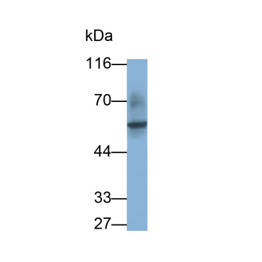 Fc Fragment Of IgG Low Affinity IIIa Receptor (FcgR3A) Human Monoclonal Antibody