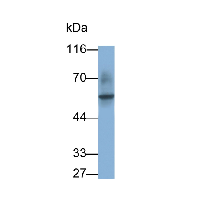 Fc Fragment Of IgG Low Affinity IIIa Receptor (FcgR3A) Human Monoclonal Antibody