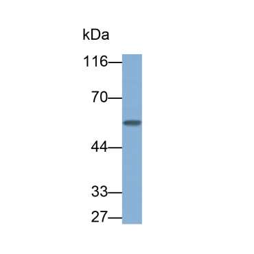 Fc Fragment Of IgG Low Affinity IIIa Receptor (FcgR3A) Human Monoclonal Antibody