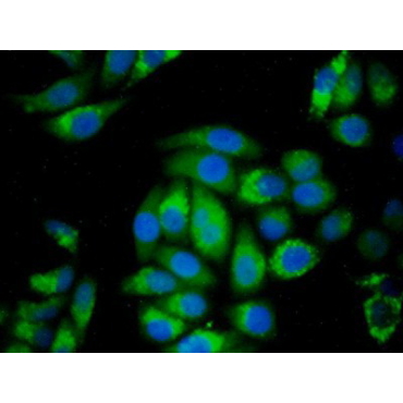 Cathepsin D (CTSD) Human Monoclonal Antibody