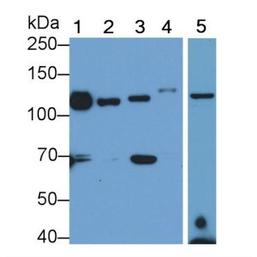 Integrin Alpha V (ITGaV) Human Monoclonal Antibody