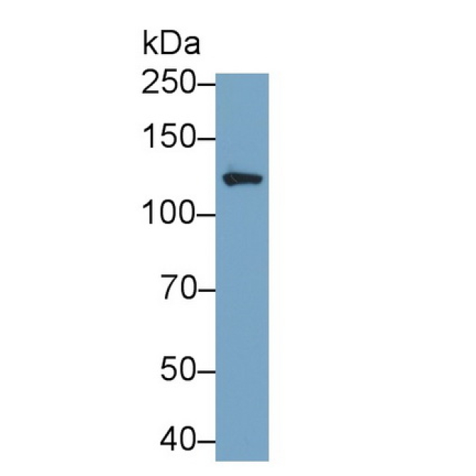 Integrin Alpha V (ITGaV) Human Monoclonal Antibody