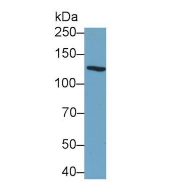Integrin Alpha V (ITGaV) Human Monoclonal Antibody