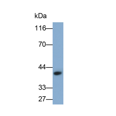 Epithelial Cell Adhesion Molecule (EPCAM) Human Monoclonal Antibody