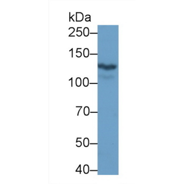 Ret Proto-Oncogene (RET) Mouse Monoclonal Antibody