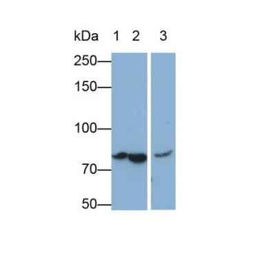 Complement C4-B (C4B) Human Monoclonal Antibody