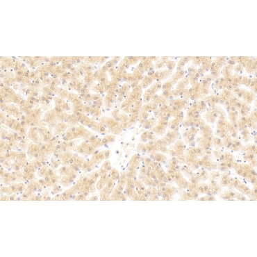 Complement C4-B (C4B) Human Monoclonal Antibody