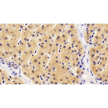 Thymic Stromal Lymphopoietin (TSLP) Human Monoclonal Antibody