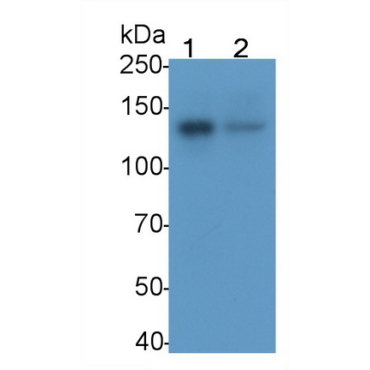 Focal Adhesion Kinase (FAK) Human Monoclonal Antibody