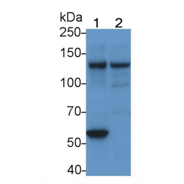 Focal Adhesion Kinase (FAK) Human Monoclonal Antibody