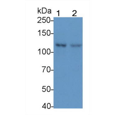 Focal Adhesion Kinase (FAK) Human Monoclonal Antibody