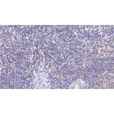 Focal Adhesion Kinase (FAK) Human Monoclonal Antibody