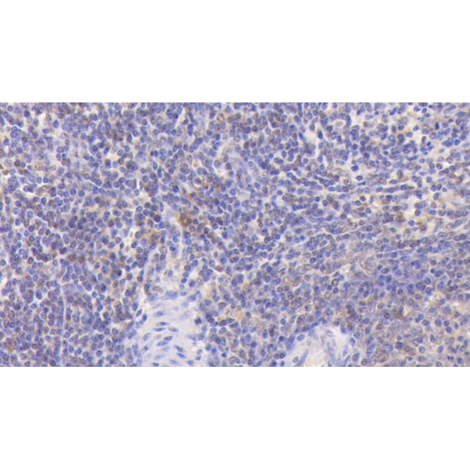 Focal Adhesion Kinase (FAK) Human Monoclonal Antibody