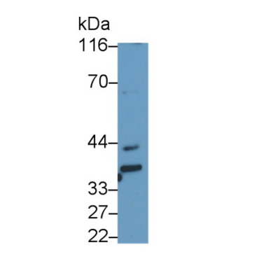 Beta-1,3-Glucuronyltransferase 1 (b3GAT1) Human Monoclonal Antibody