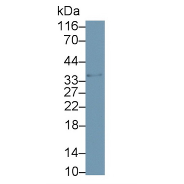 Beta-1,3-Glucuronyltransferase 1 (b3GAT1) Human Monoclonal Antibody