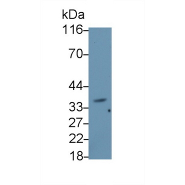 Beta-1,3-Glucuronyltransferase 1 (b3GAT1) Human Monoclonal Antibody